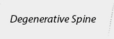 Degenerative Spine - Mohammed Khaleel, MD - Orthopaedic Spine Surgeon